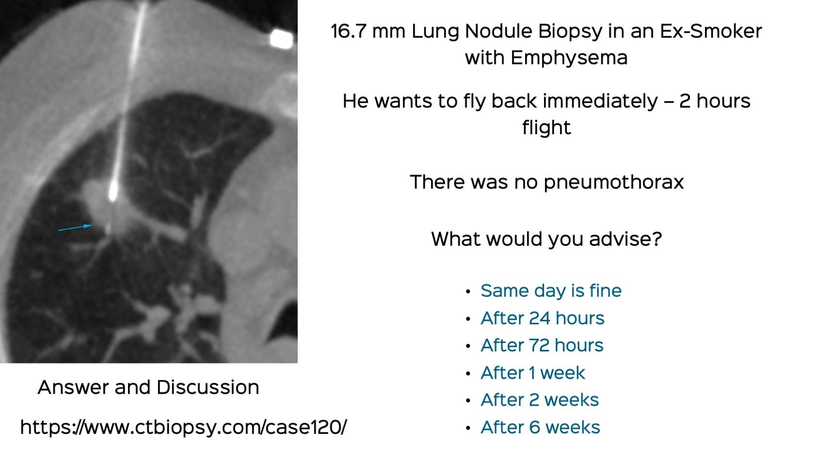 Case 120: Right Upper Lobe Lung Nodule Biopsy - Patient Wants to Fly Back Immediately