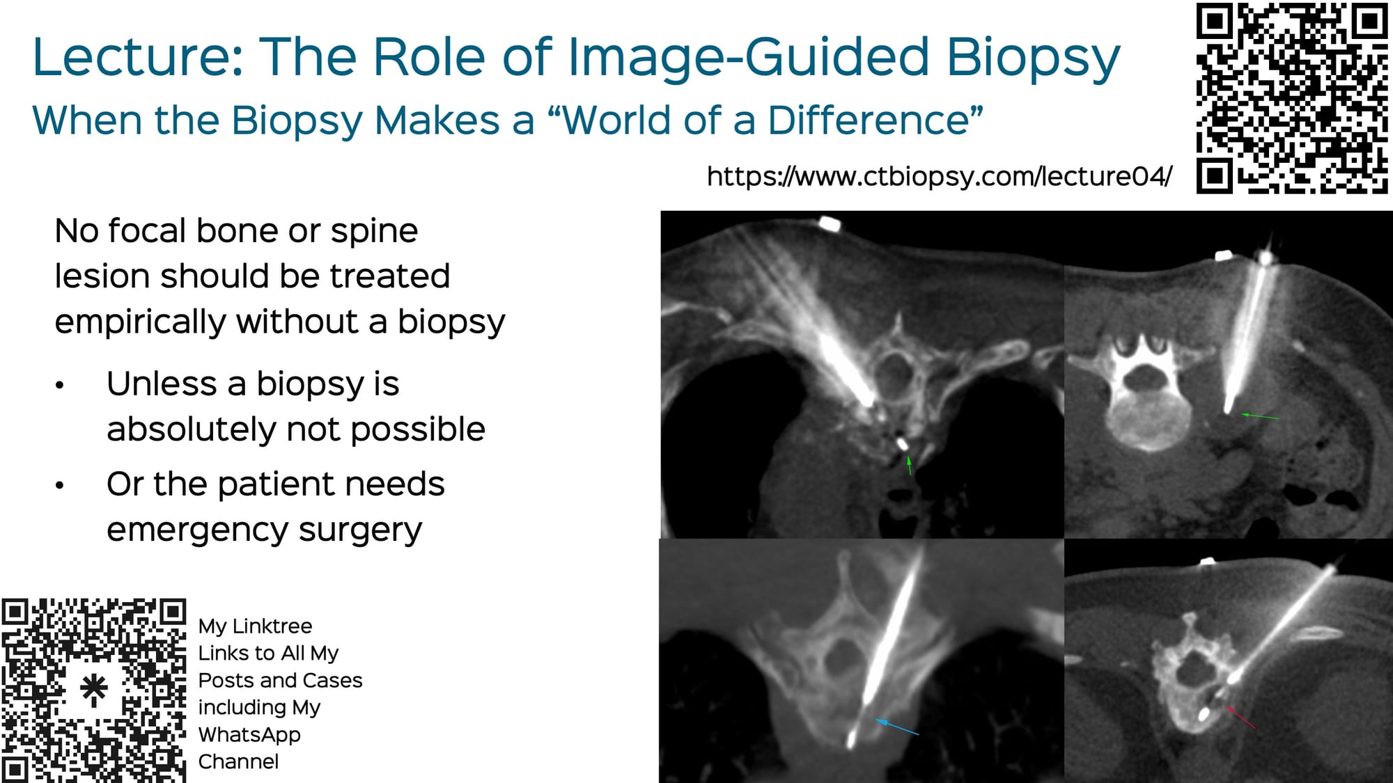 Lecture: The Role of Image-Guided Biopsy - When the Biopsy Makes the "World of a Difference"