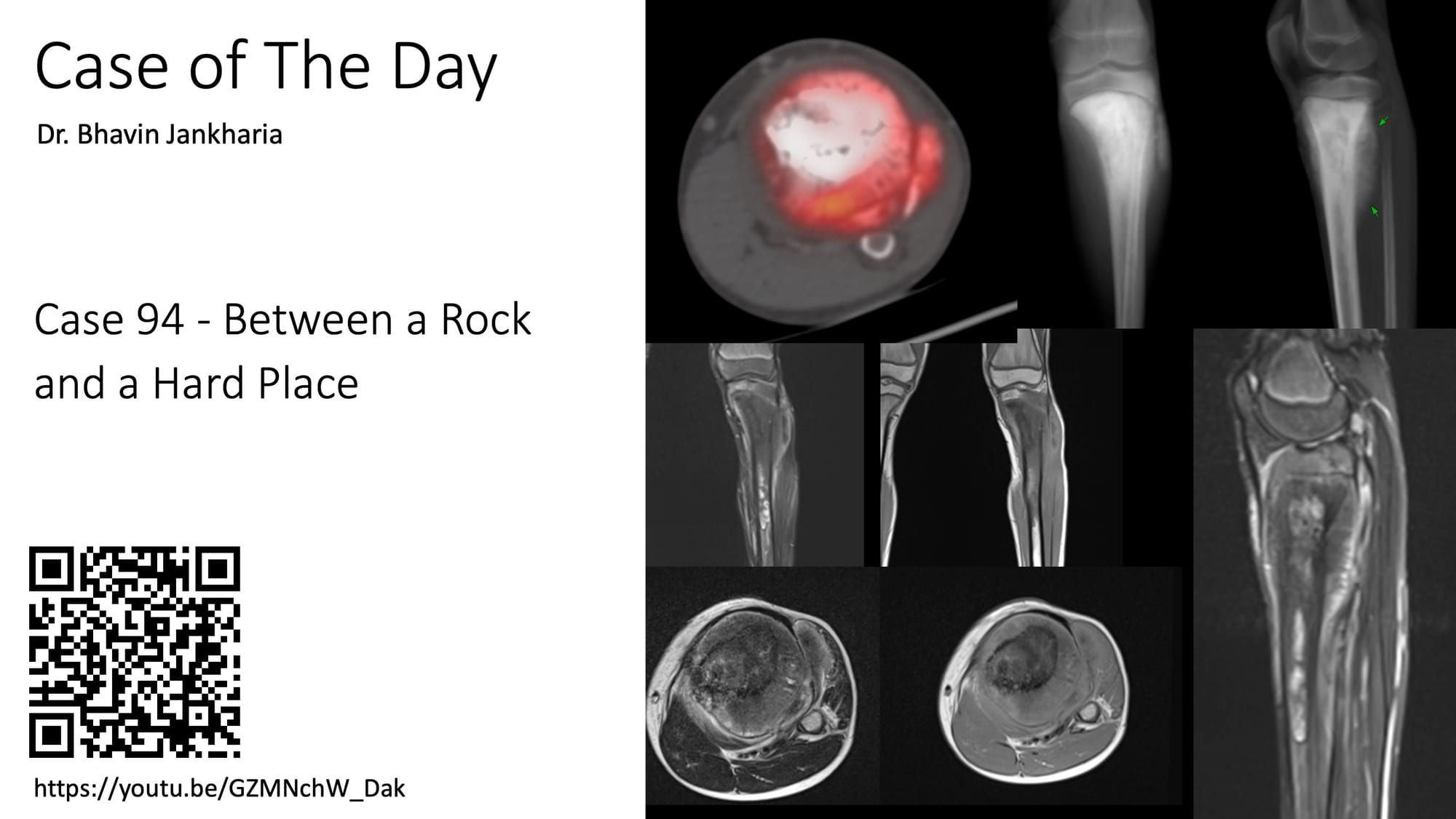 Case of the Day - 094 - 2025 09 01 - Between a Rock and a Hard Place