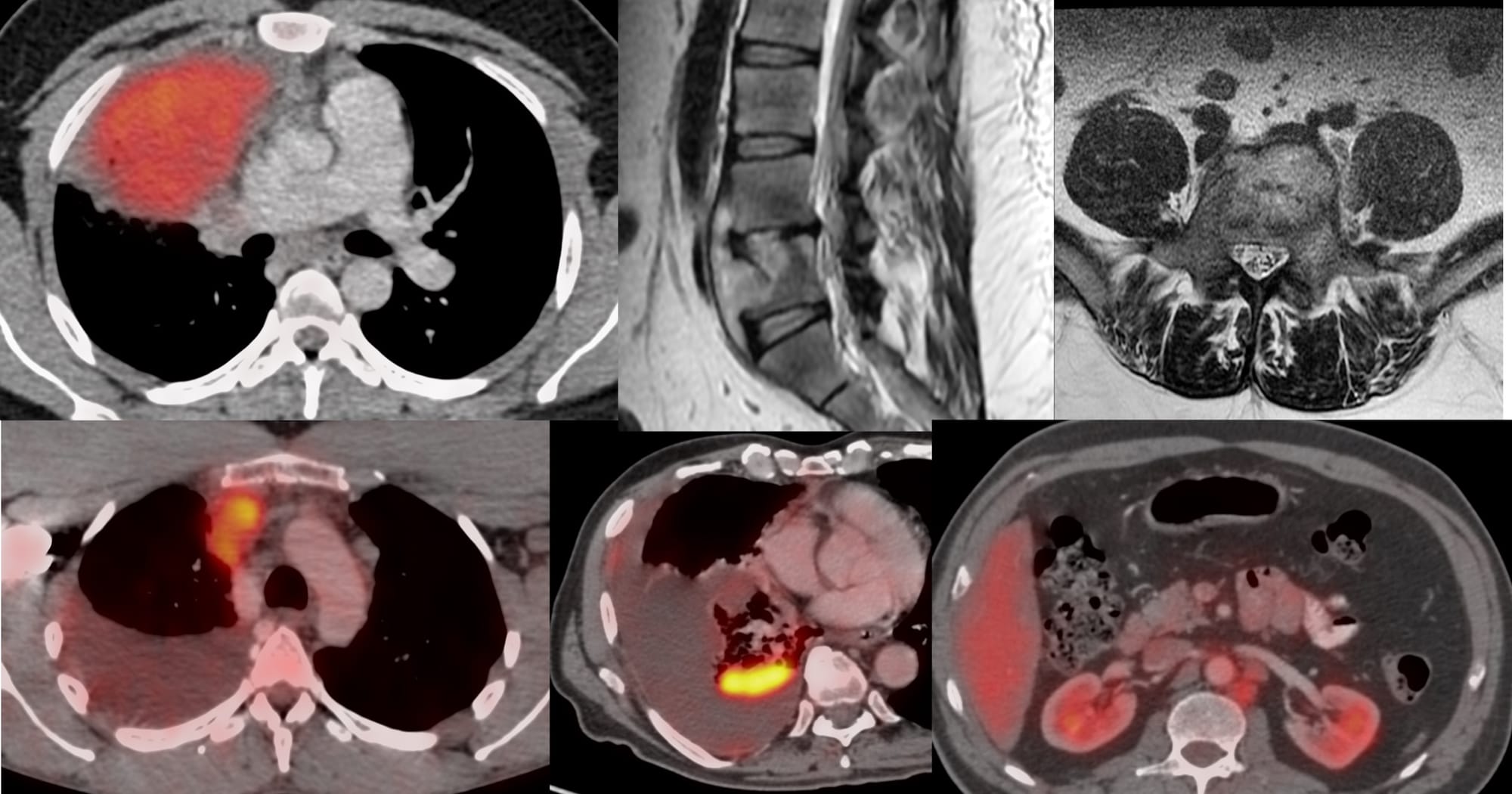CT Biopsy Live - 5 Cases from Feb 2026 - 19th March, 2026 - 7 PM