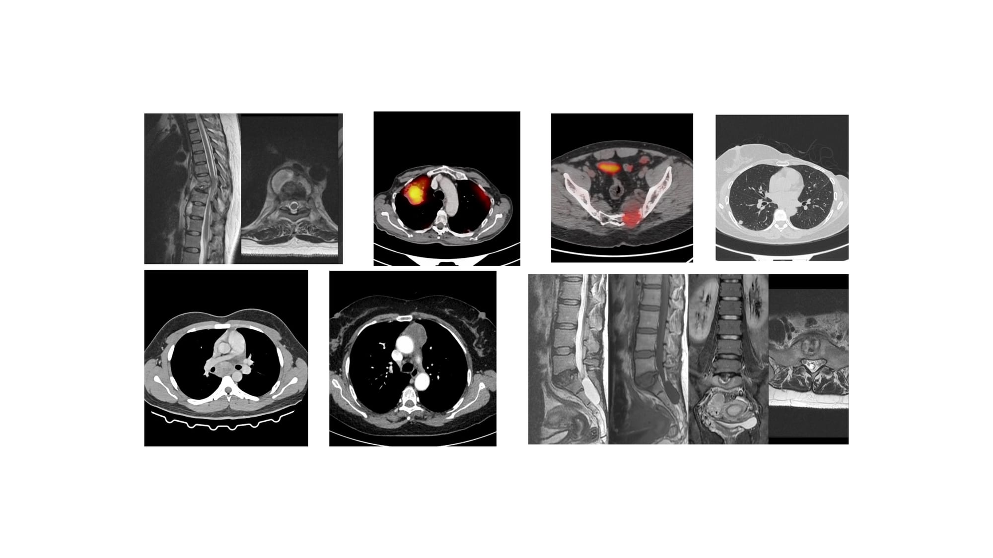 Live Session - Discussion of Dec 2025 Cases