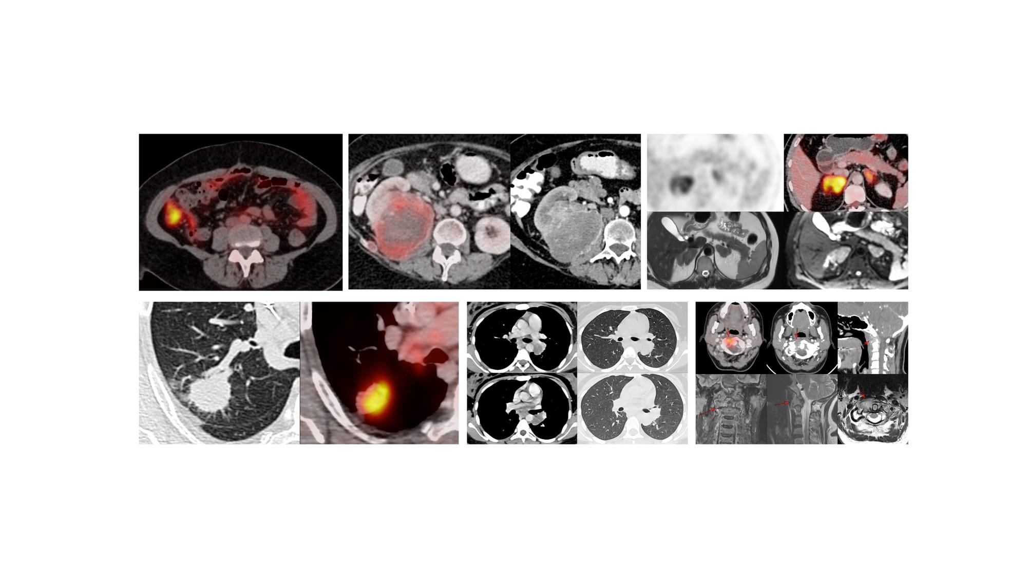 Live Session - Discussion of Jan 2026 Cases